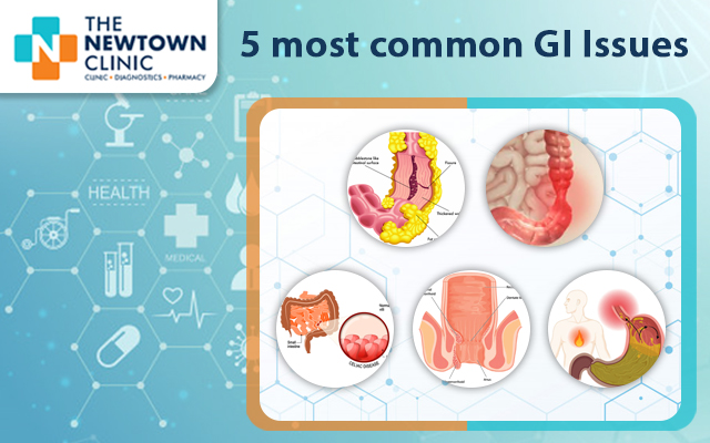 5 most common GI Issues