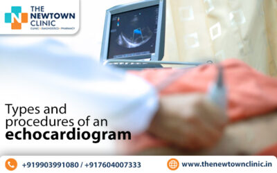 Types And Procedures Of An Echocardiogram - The Newtown Clinic