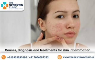 best dermatology clinic in New Town