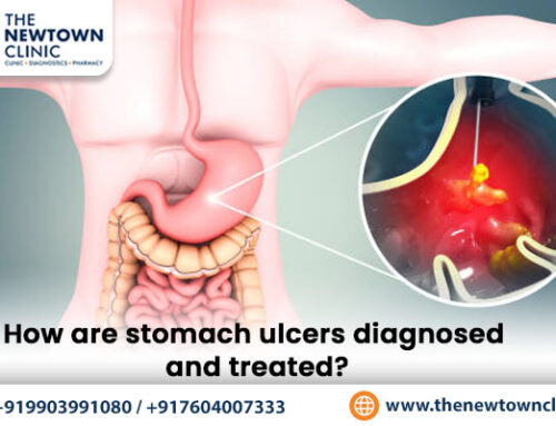 How are stomach ulcers diagnosed and treated?
