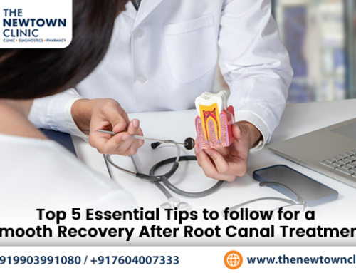 Top 5 Essential Tips to follow for a Smooth Recovery After Root Canal Treatment