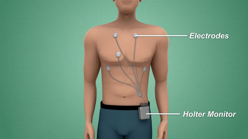 Holter monitoring lab in New Town, Salt Lake, and Rajarhat