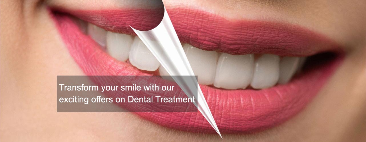 Transform your smile