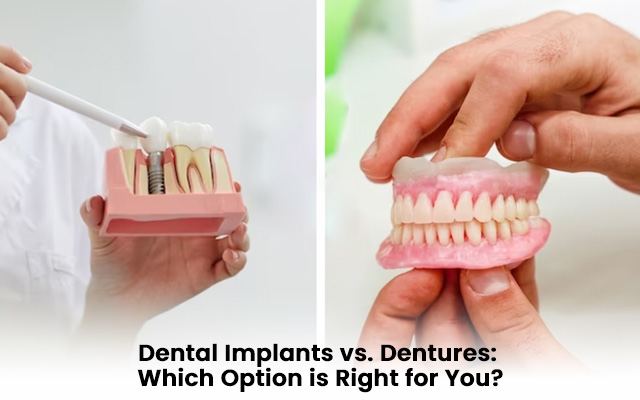 Dental Implants vs. Dentures: Which Option is Right for You?