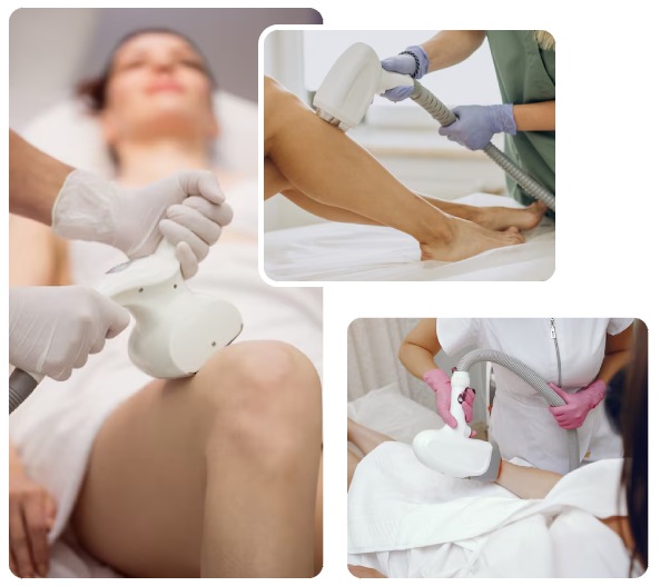 Reasons of Laser Hair Removal