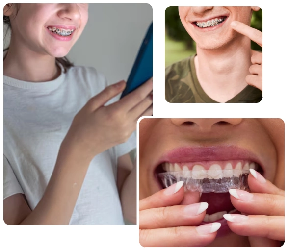 Advantages of Teeth Alignment