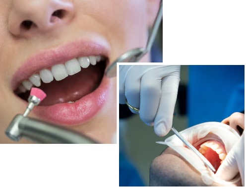 Causes of Advanced Gum Disease