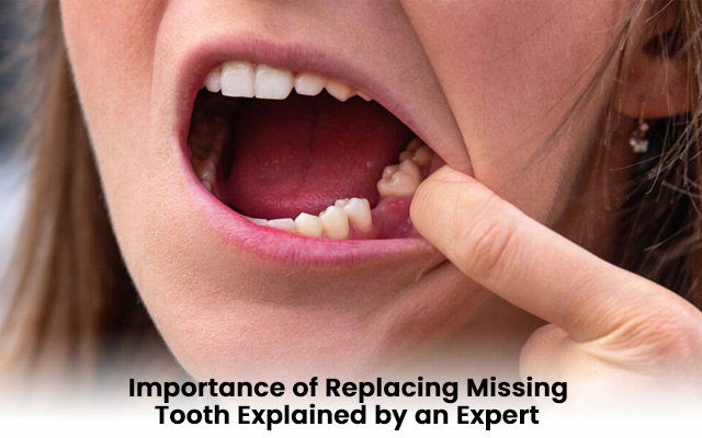 The Importance of Replacing Missing Tooth Explained by an Expert