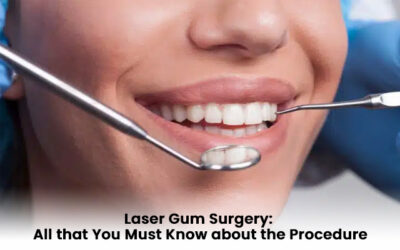 Laser Gum Surgery: All that You Must Know about the Procedure