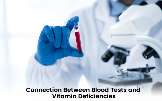 Connection Between Blood Tests and Vitamin Deficiencies